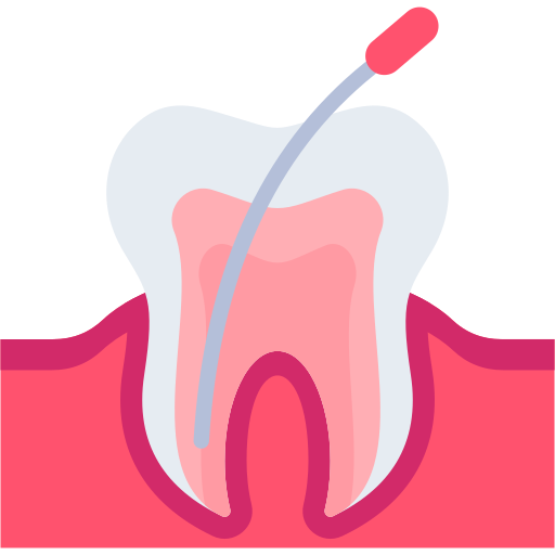 Endodontic Treatment