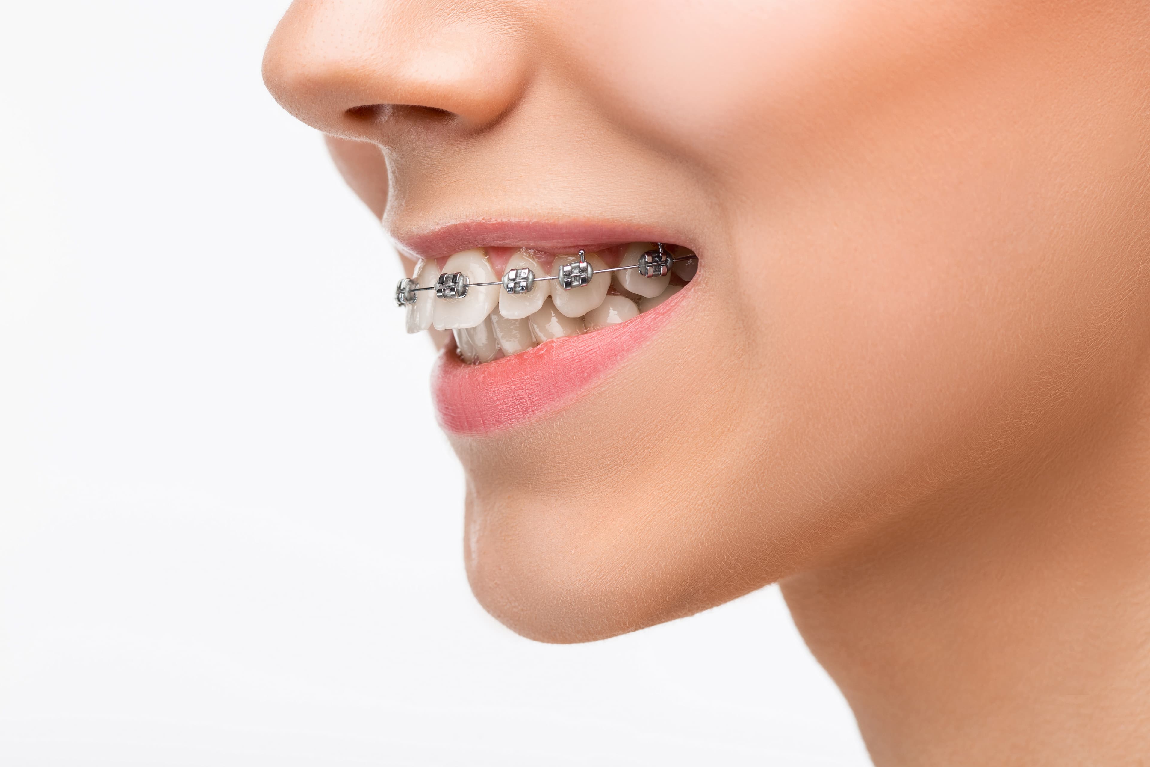 Orthodontics: Benefits and Procedures